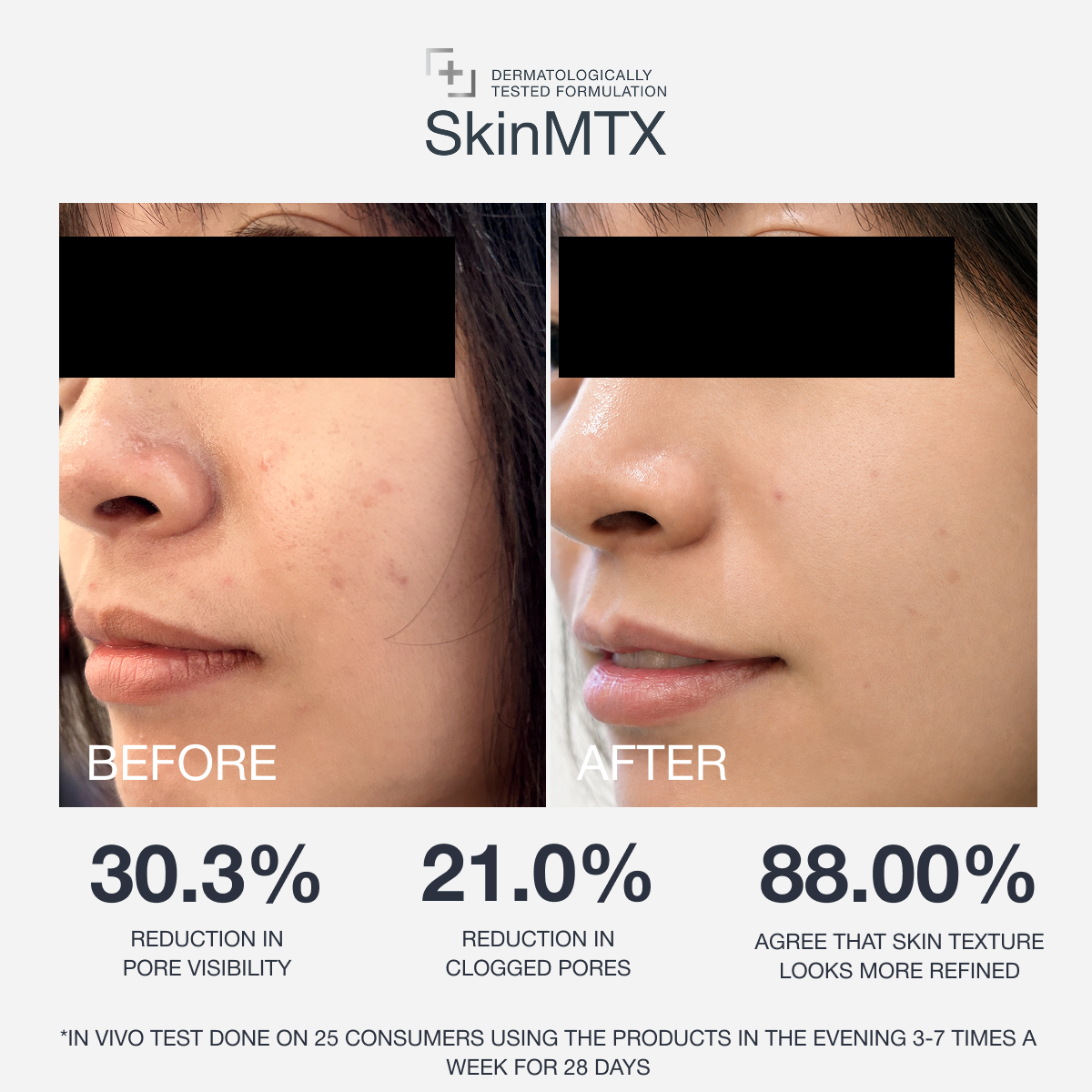 20% Niacinamide Concentrate