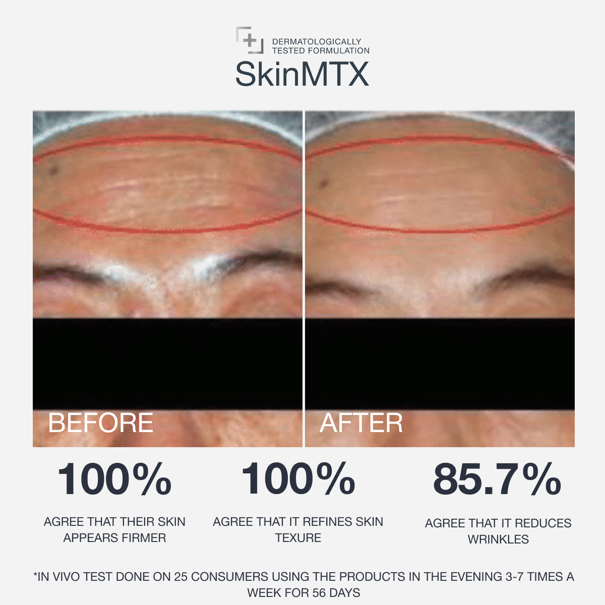 Intense RejuvorA™ Cream