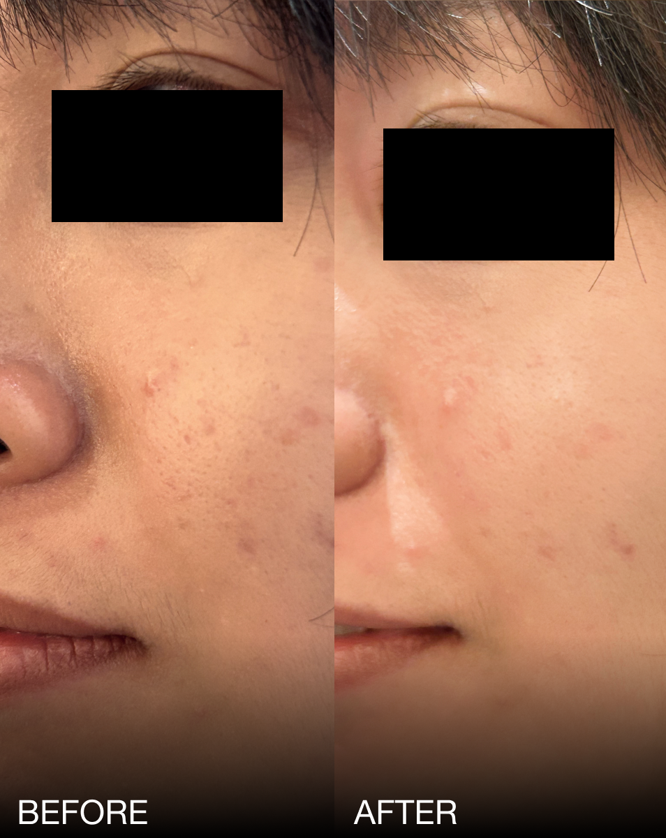 20% Niacinamide Concentrate